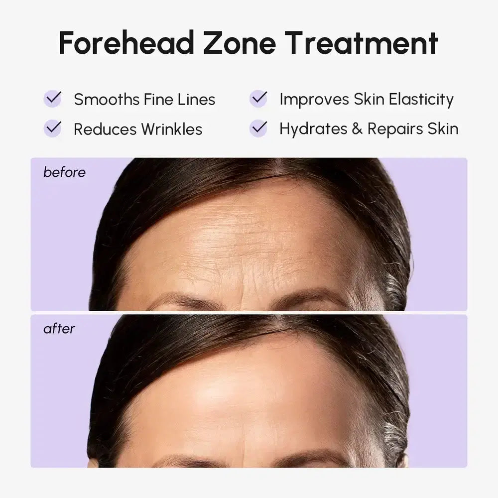Under-Eye Hydrogel Patches